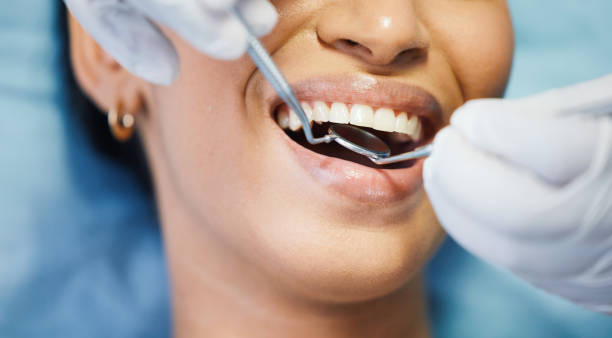 Emergency Dental Filling Replacement in OK